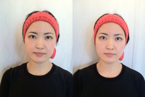 before after