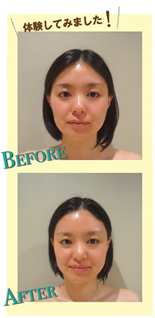 ビフォーアフター
