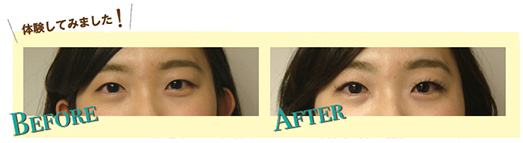 lasgtokyo-beforeafter1