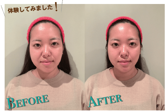 %e3%83%9c%e3%83%b3%e3%82%ad%e3%82%b4%e3%83%b3beforeafter-min